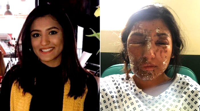 "In an article Friday titled, 'Acid attacks: What has led to the rise and how can they be stopped?,'  George Mann of the BBC noted that assaults involving corrosive substances have more than doubled in England since 2012, that the vast majority of cases were in London, and that this spike 'means the UK has the highest number of reported acid attacks per capita in the world,' according to the London charity Acid Survivors Trust International.  What Mann didn't note in his article is any variation on the words 'Islam,' 'Muslim,' or 'immigrant.' - Truth Revolt 