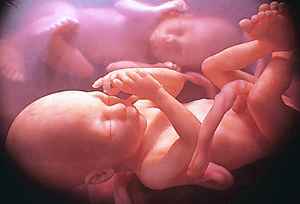 While this is a model, National Georgraphic has now shown actual multiple babies in the womb. They have discovered that when they leave the womb, they play similar to the way they played in the womb. Do you have one of these at home or did they convince you it was better you didn't raise one of these.
